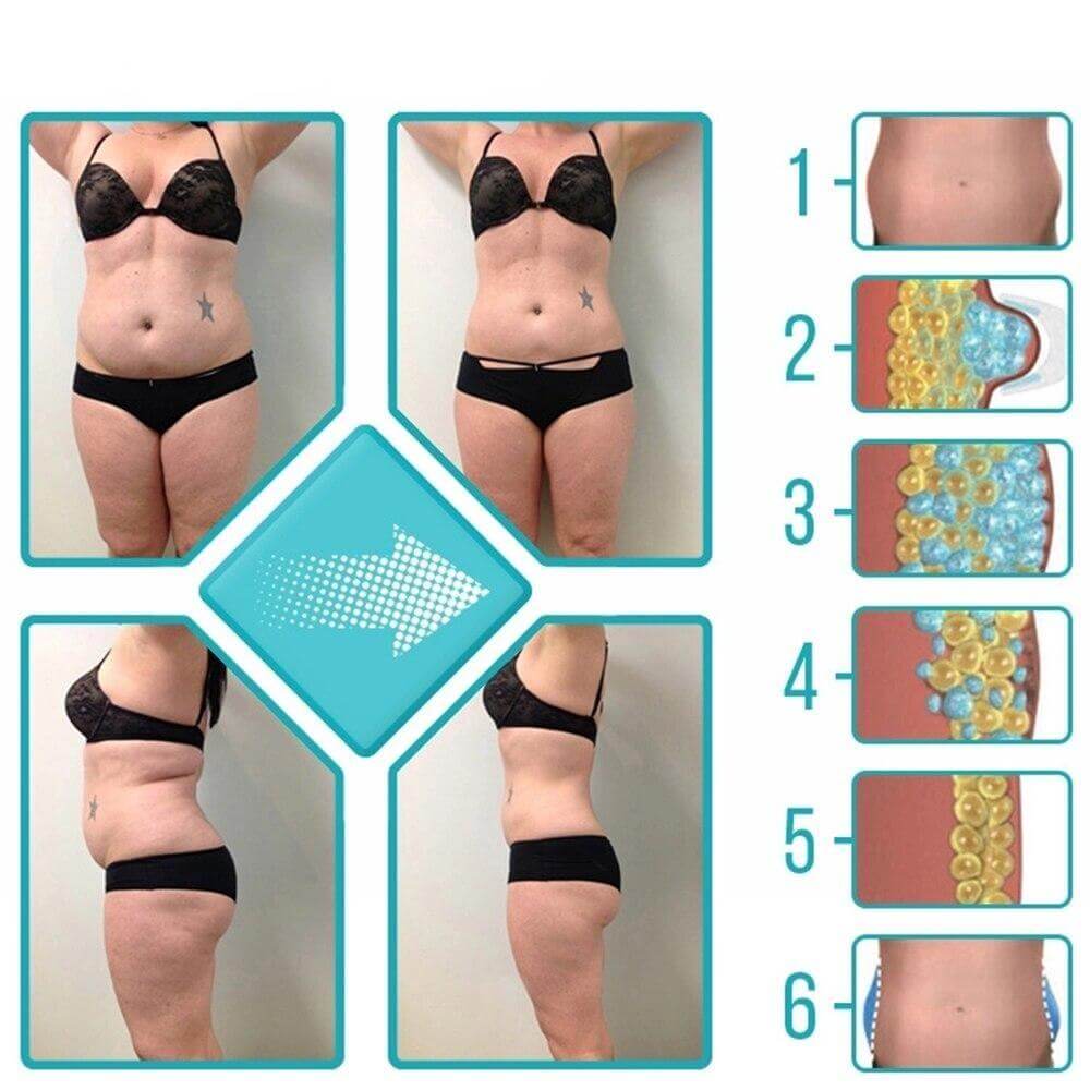 Effet de la Ceinture à Cryothérapie sur le corps d'une femme