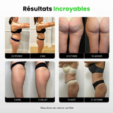 3D Anti Cellulite Slimming Leggings